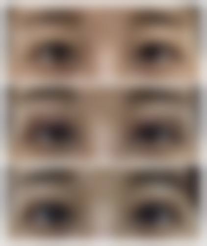 六、蚌埠涵韩整形医院价格表