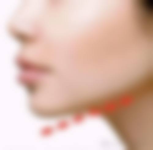 四、韩国thewclinic整形医院特色项目