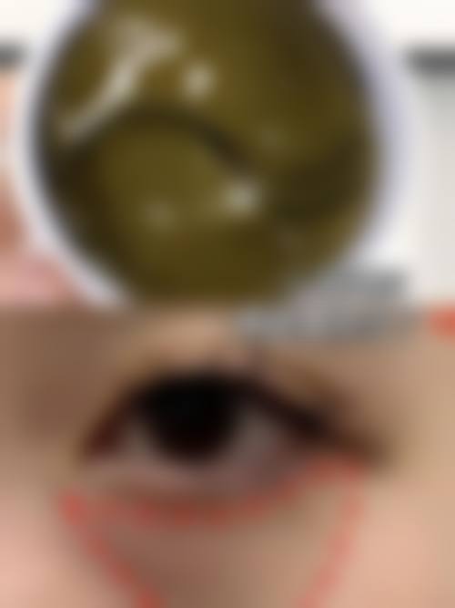 四、北京禧悦医疗整形医院特色项目