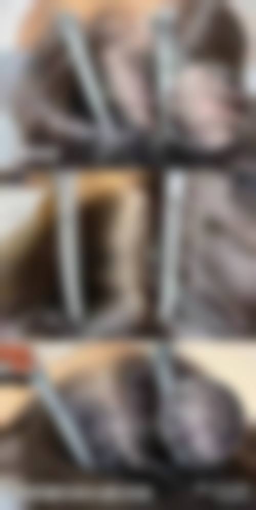 四、上海明珠医院整形美容中 心特色项目