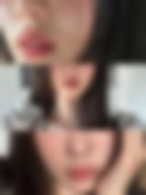 四、南昌伊丽医疗美容整形医院特色项目