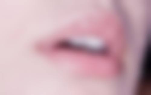 九、北京禧悦医疗整形医院真实的患者评价