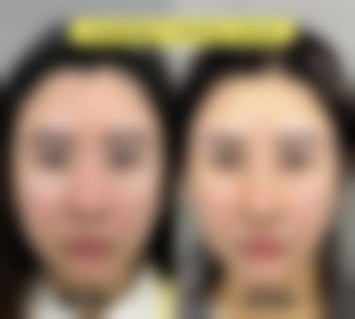 八、北京禧悦医疗整形医院预约方式