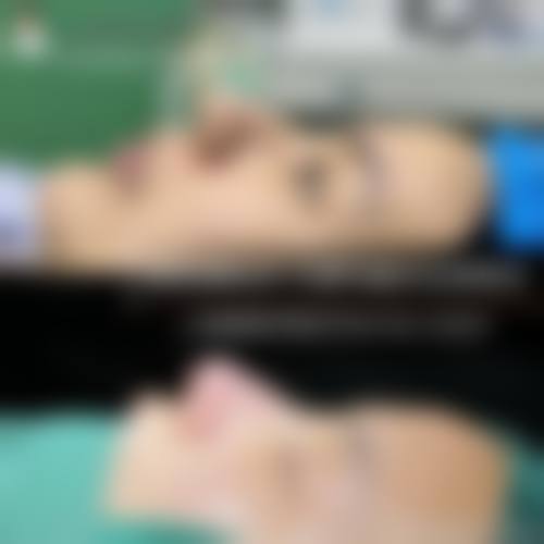 六、北京禧悦医疗整形医院价格表