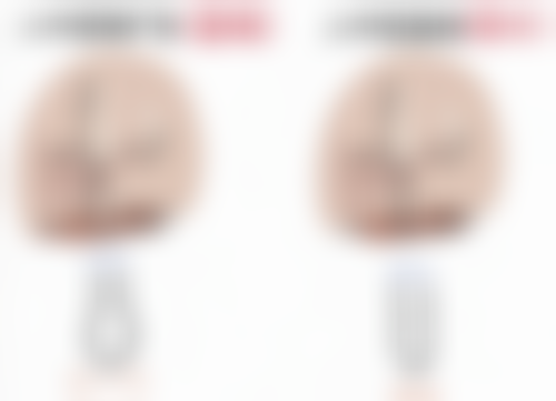 八、结尾：瘦脸针能改善大小脸吗？