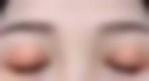 六、如新眼部导头的市场反馈和口碑