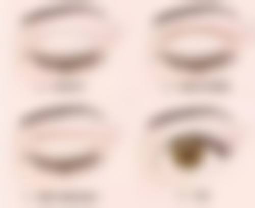 颈部有疤痕怎么办？了解常见类型及对策，附图片对比助你选对祛疤方法！ 