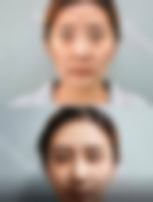 四、北京协和医院整形美容外科中 心特色项目