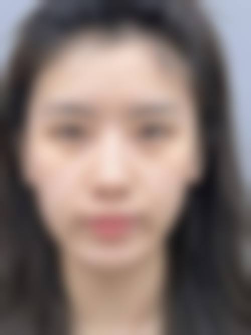 五、临夏姜医生医疗美容诊所价格表