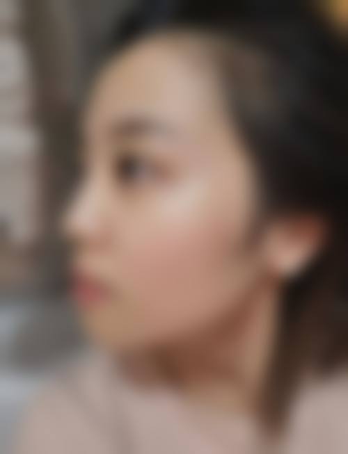 八、兰州邦媛姣兰医疗美容门诊部真实的患者评价