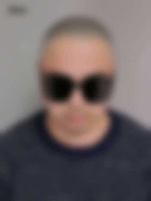 八、中山植德植发医院真实的患者评价