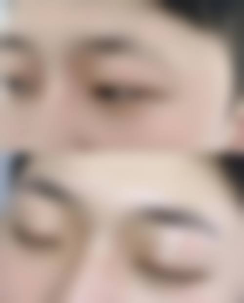 二、中山植德植发医院怎么样？