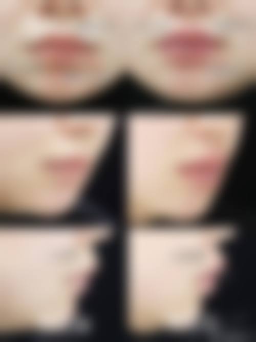 二、兰州邦媛姣兰医疗美容门诊部怎么样?