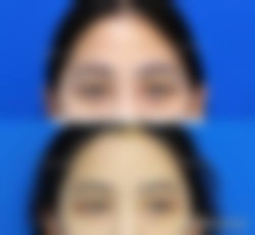 五、兰州邦媛姣兰医疗美容门诊部价格表