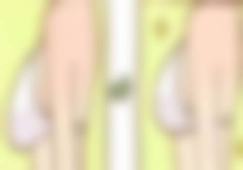 三、影响双眼皮切完修复时间的因素