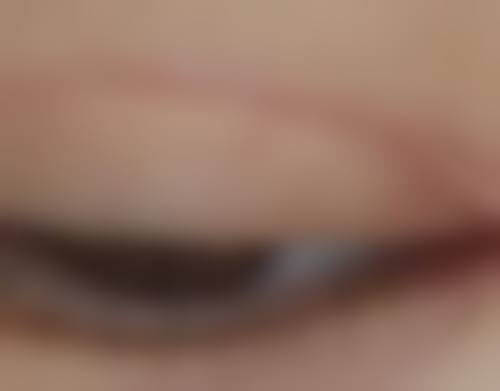 二、不同阶段的修复时机建议