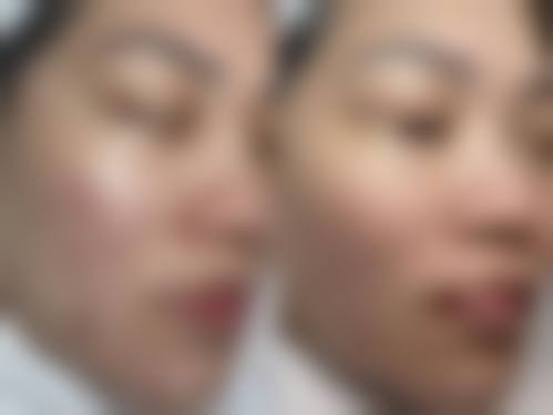 三、南宁云美医疗美容门诊部诊疗项目有哪些？