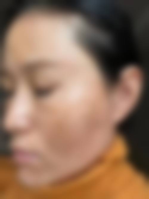 四、南宁云美医疗美容门诊部特色项目