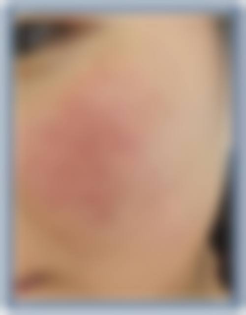 九、眉山华信整形医院真实的患者评价