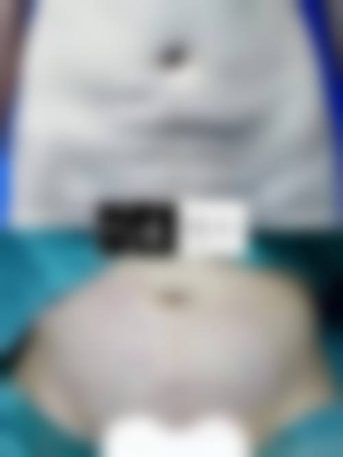 八、郑州安美星河医疗美容门诊部真实的患者评价