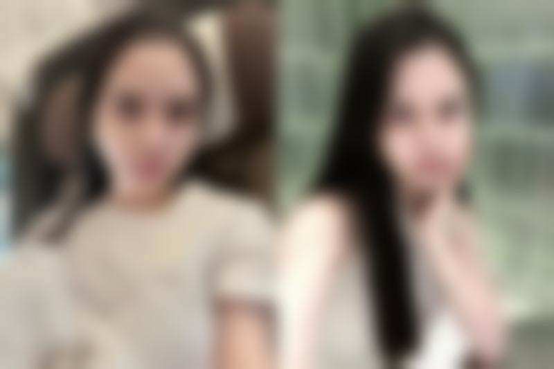 面部摔伤疤痕多久能好？多久才能褪色？这些因素决定恢复时长！ 