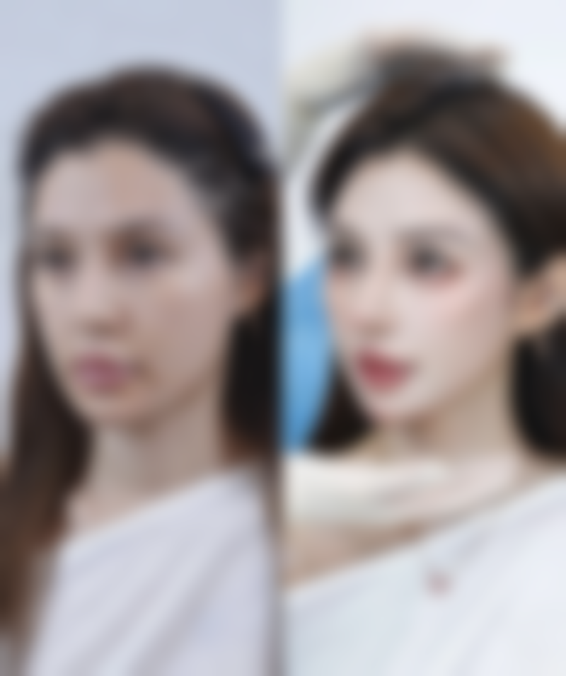 四、过量注射或频繁补打的危害