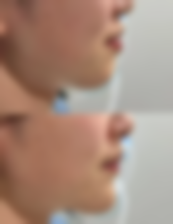 六、温州医 科 大学附属第二医院价格表