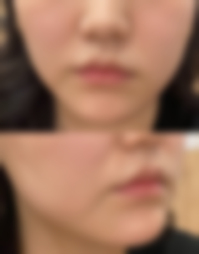 六、眉山华信整形医院价格表