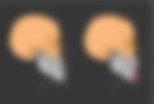 六、方明真实的患者评价