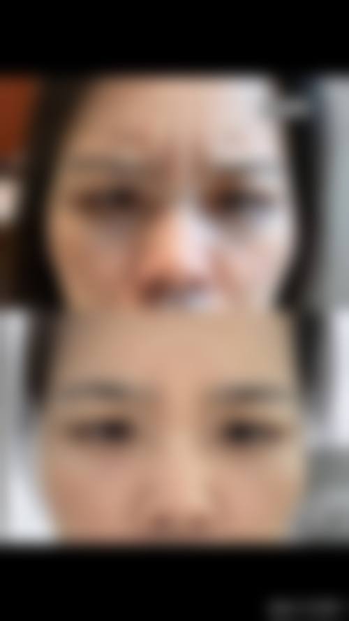 二、临沂医恒美整形医院怎么样？