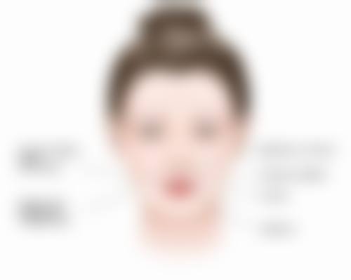 二、请问疤痕疙瘩刺痛外用药有哪些