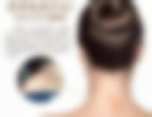 四、请问疤痕疙瘩刺痛不同症状缓解方案