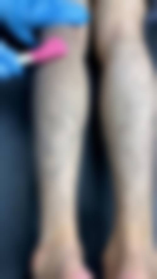 四、长春非凡医疗整形医院特色项目