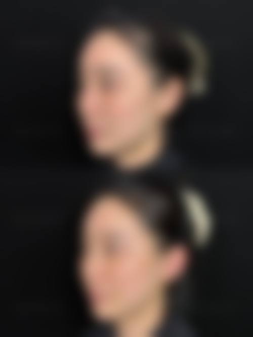 八、长春非凡医疗整形医院真实的患者评价