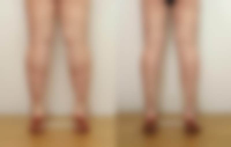 韩国sage医院李敬秀预约方式大揭秘，含官网、电话、微信等多种途径及注意事项 