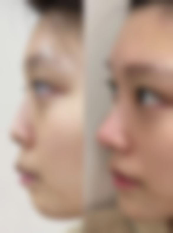 二、南充韩美整形医院怎么样?