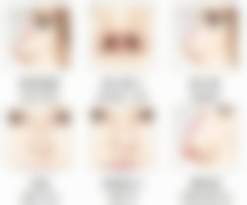 四、美学修复建议