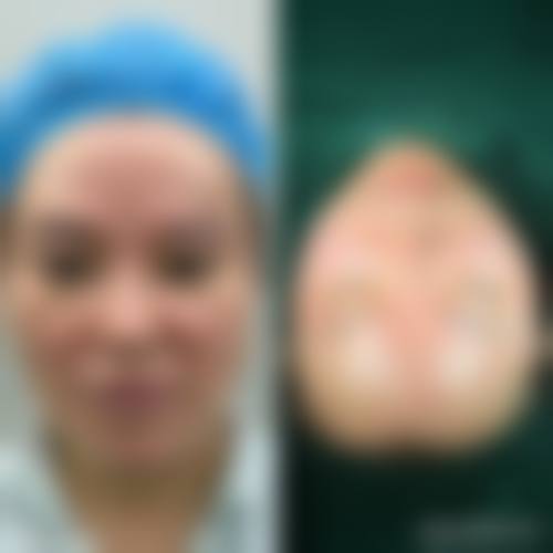 八、深圳皓白乐佳整形医院真实的患者评价