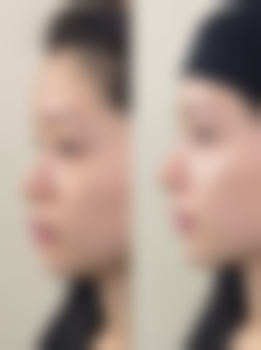 三、修复阶段与同房时间参考