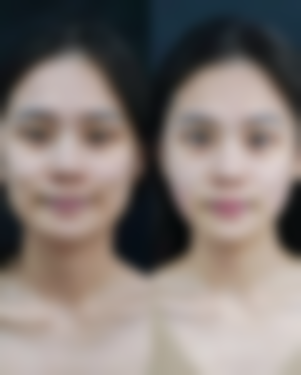 五、术后护理建议