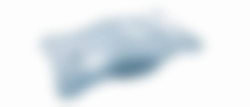 一、吸脂14天短暂脱塑身衣的可行性