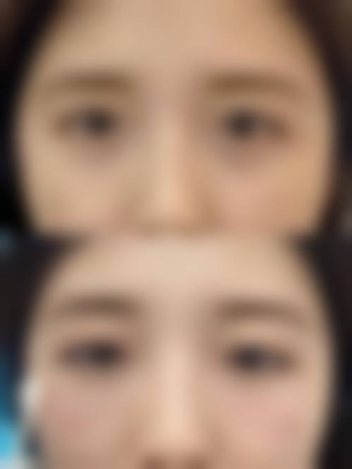 四、杭州光梭医疗美容诊所特色项目