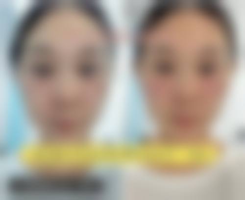 九、杭州光梭医疗美容诊所真实的患者评价