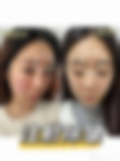 四、深圳蒂瑞整形医院特色项目