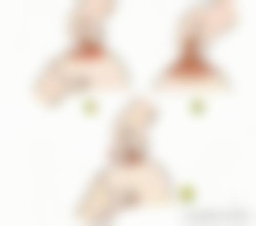 五、深圳蒂瑞整形医院价格表