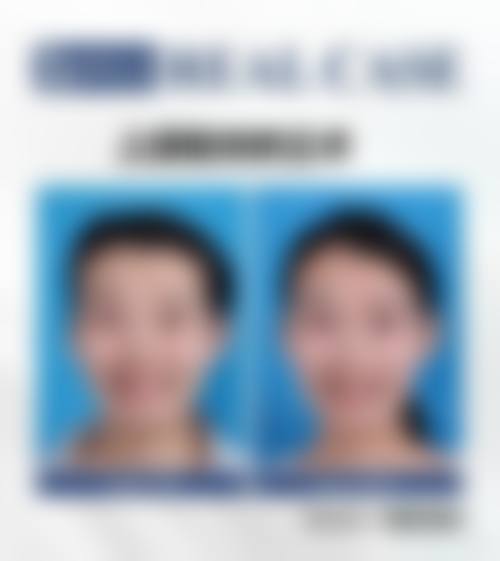 八、深圳蒂瑞整形医院真实的患者评价