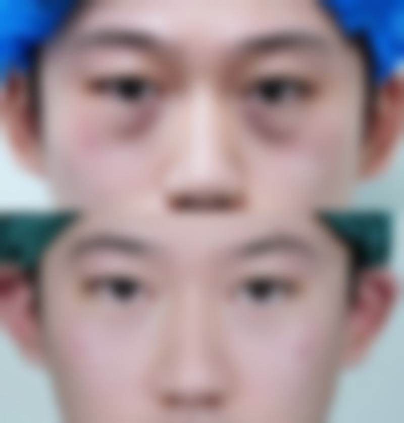 四、内蒙古包头乔兮予时整形医院特色项目