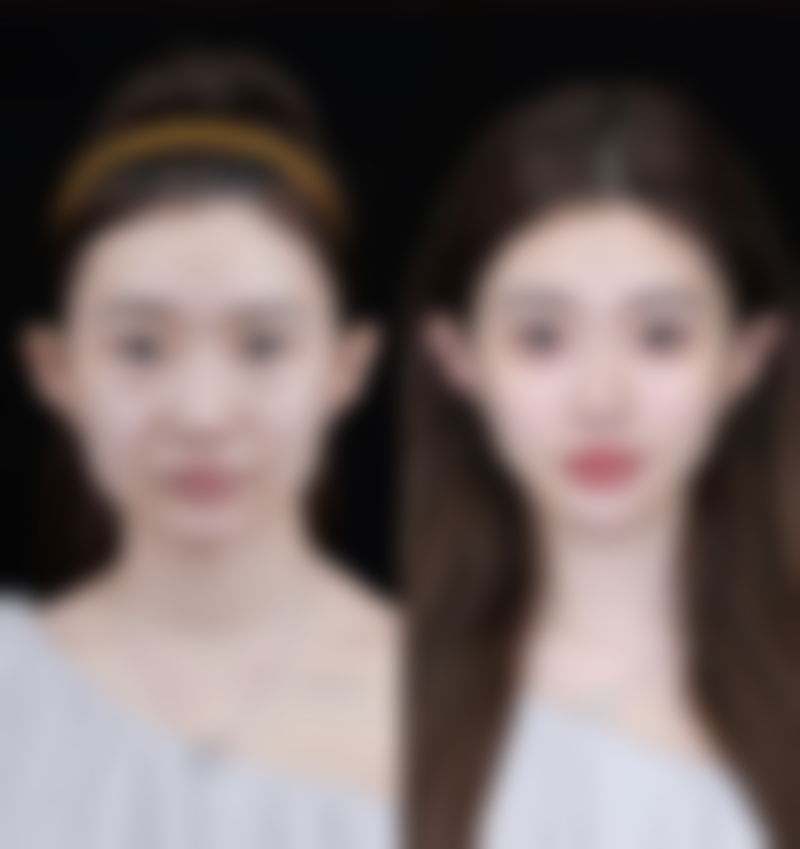 六、杭州光梭医疗美容诊所价格表