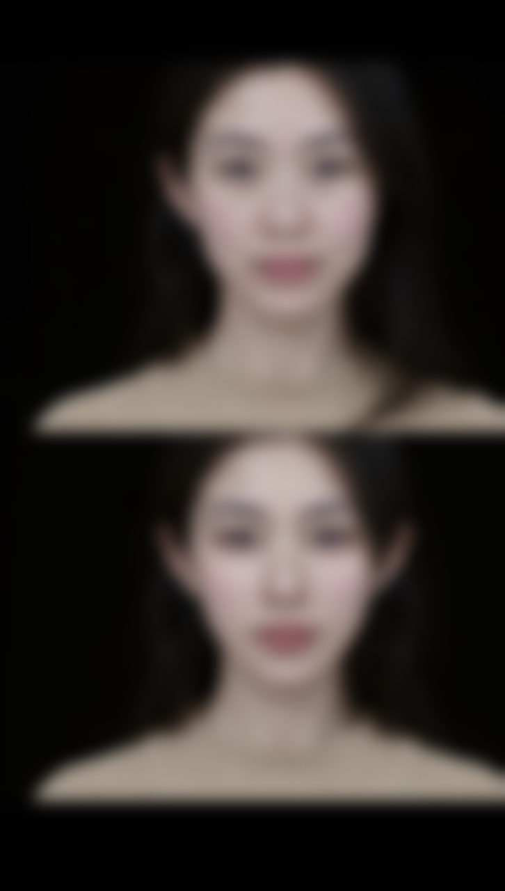 二、分阶段护理消除疤痕色素沉着