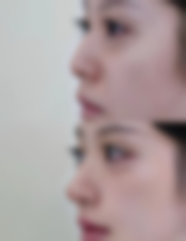 一、疤痕色素沉着的成因